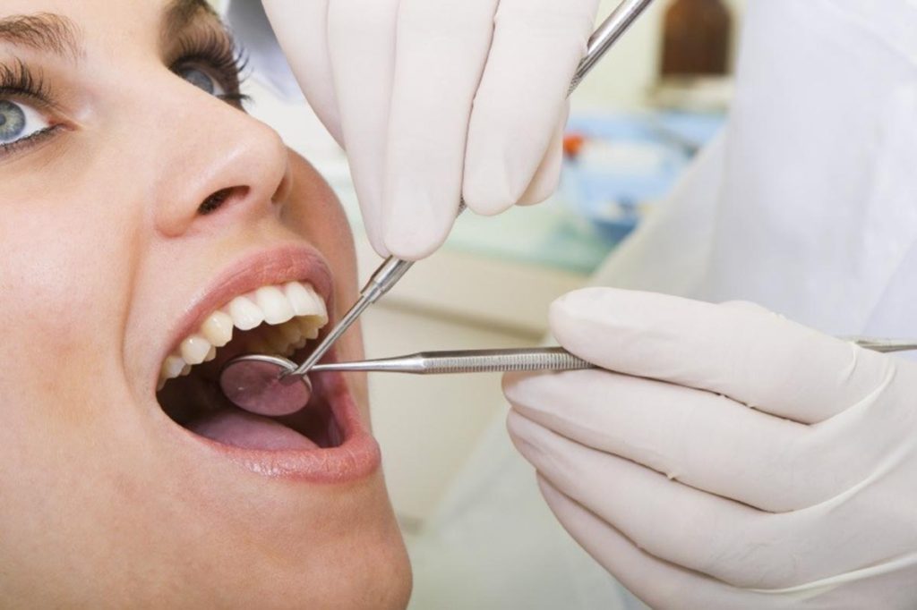 Dental Checkups in Mississauga