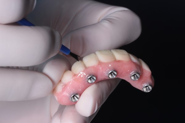 Dentures in Mississauga