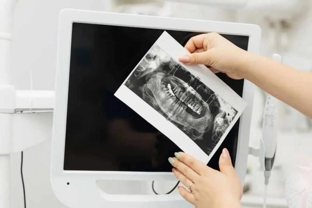 Oral Cancer Screening in Mississauga