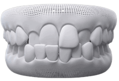 Invisalign Clear Aligner in Mississauga