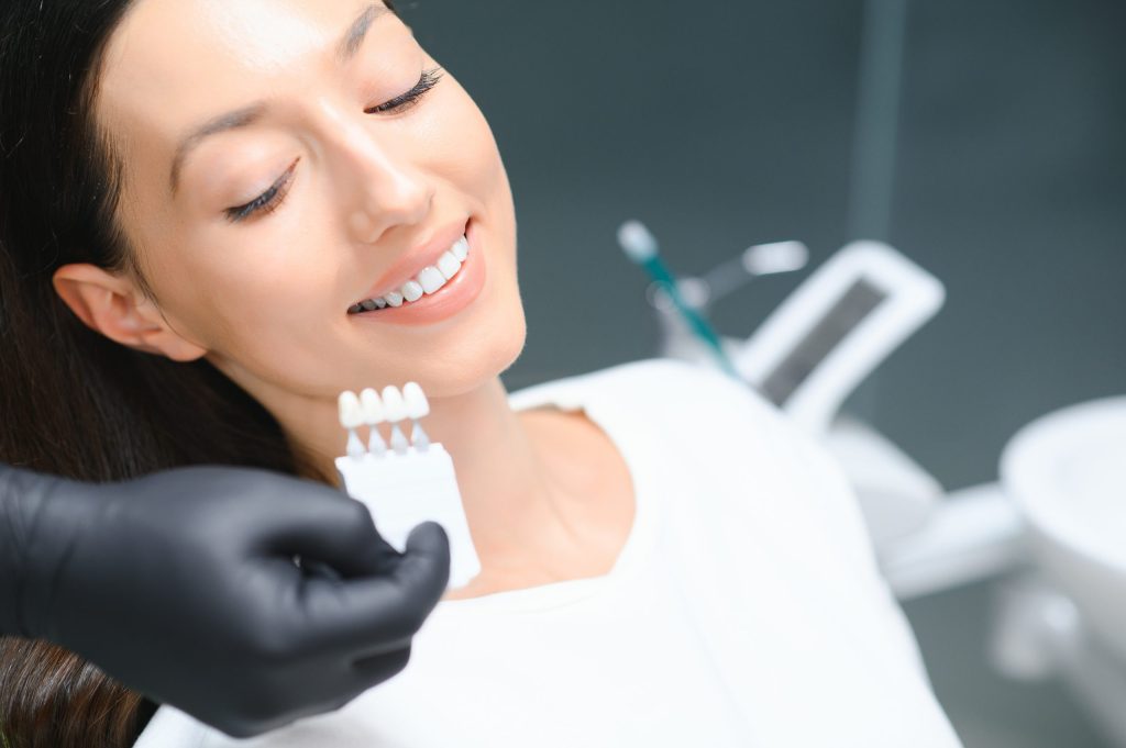 Dental Veneers in Mississauga
