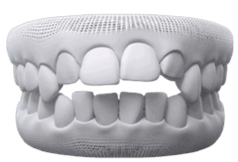 Invisalign Clear Aligner in Mississauga