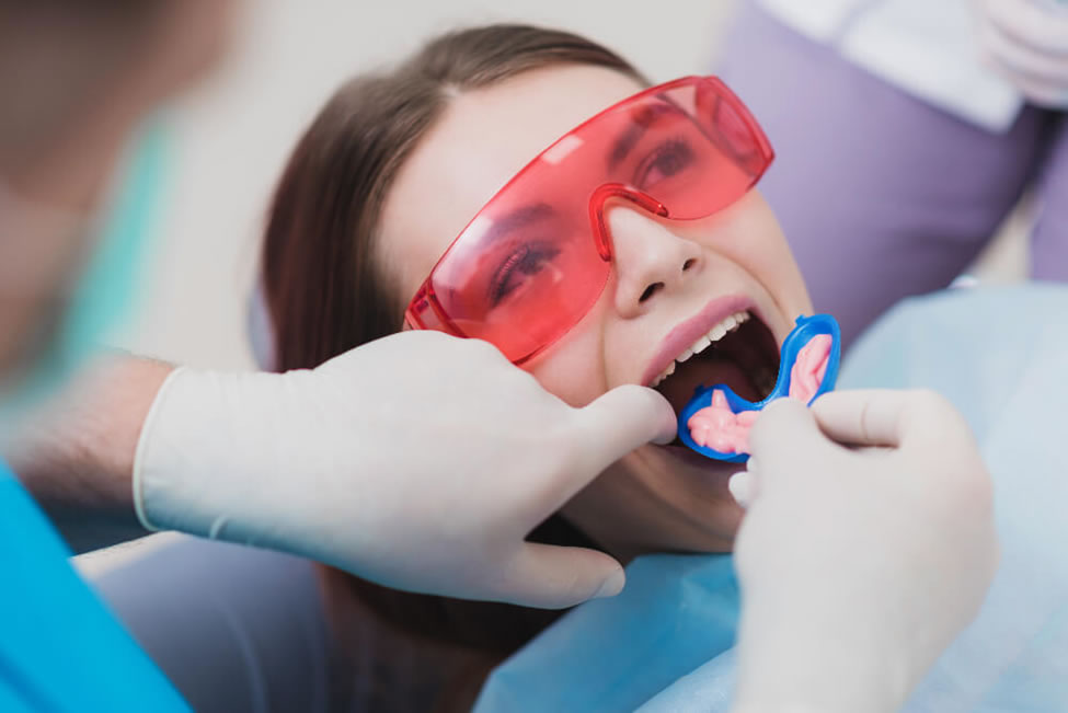 Fluortide Treatment in Mississauga