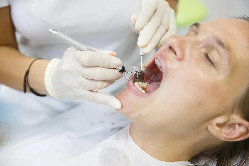 Root Canal Treatment in Mississauga