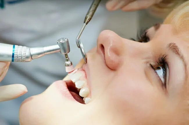 Teeth-Cleaning-5